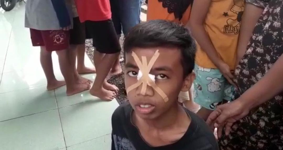 Hujan Angin Terjadi di Bukateja, Puluhan Rumah Rusak dan Satu Warga Alami Luka