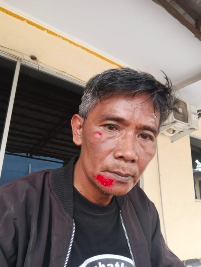 Pimpinan Redaksi Media Online Aktual Banten Diduga Dianiaya Oknum Debt Colektor