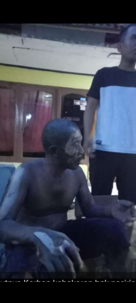 TABUNG GAS MELEDAK, SEORANG NENEK TERBAKAR SAAT SEDANG MANDI
